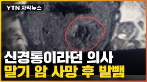 [자막뉴스] 신경통이라던 대학 병원 의사... 사망 후 밝혀진 충격적 결과 / YTN