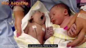 O coração desta mãe doeu quando ela viu a cabeça do seu bebê. Mas esse era o desejo dela.
